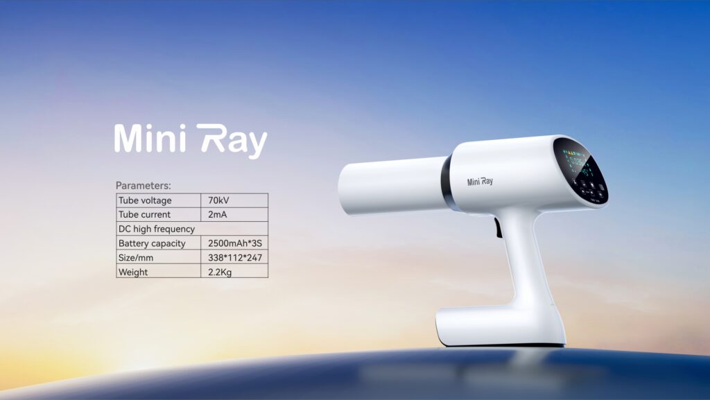 Mini ray x quang cầm tay